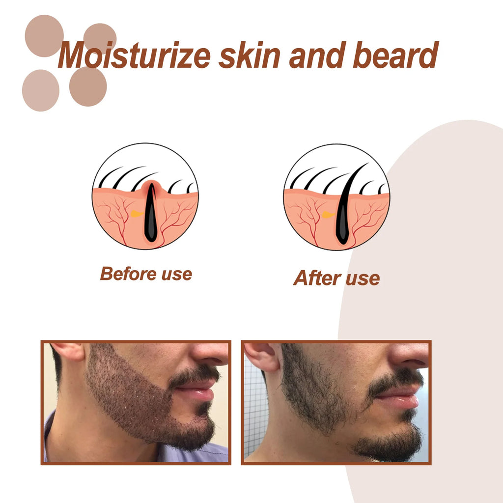 30ml Beard Growth Care Oil For Men